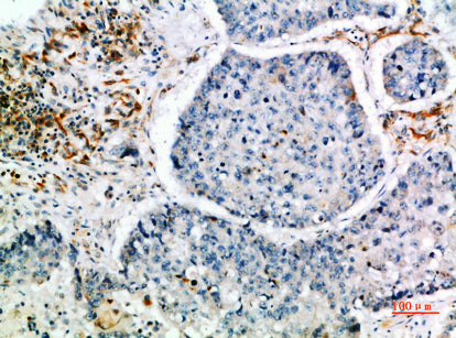 CIS Rabbit Polyclonal Antibody