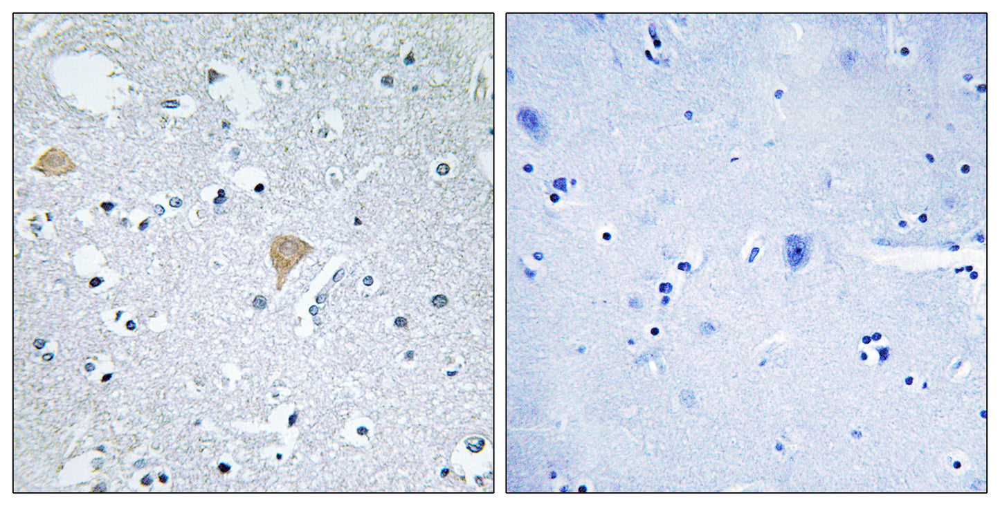 Citron Rabbit Polyclonal Antibody