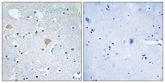 Citron Rabbit Polyclonal Antibody