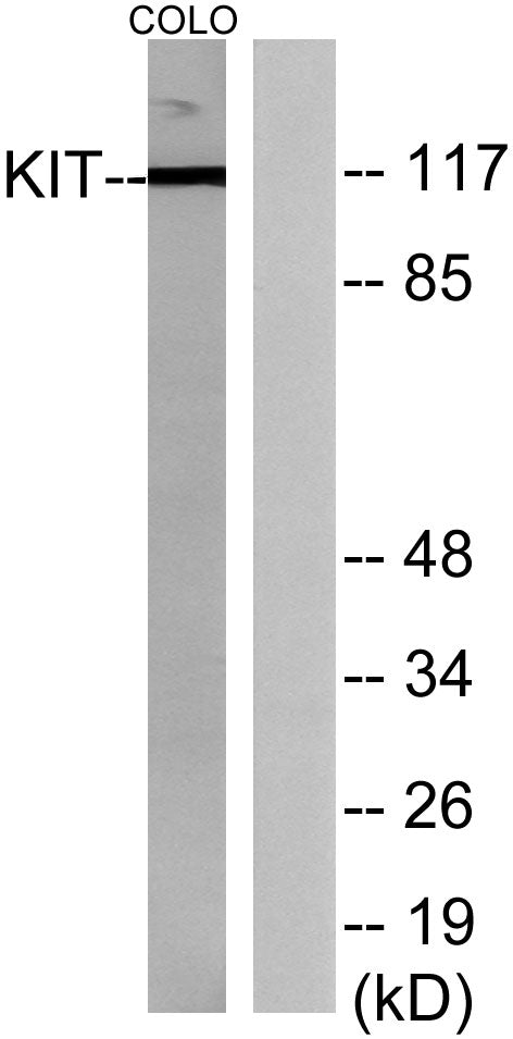 c-Kit Rabbit Polyclonal Antibody