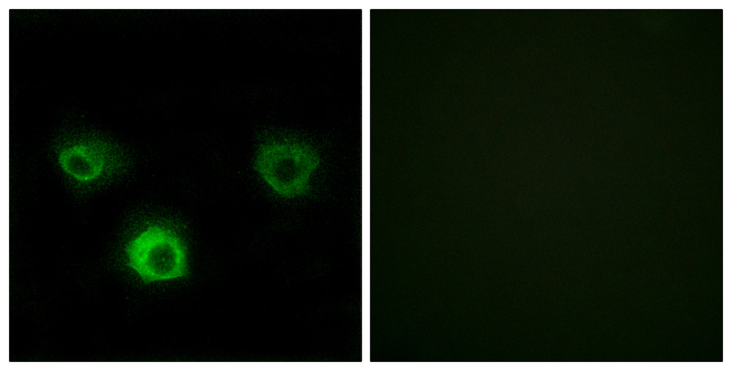 CKR-4 Rabbit Polyclonal Antibody