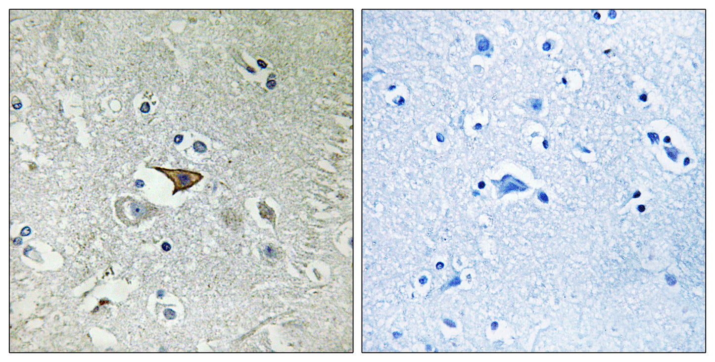 CKR-5 Rabbit Polyclonal Antibody