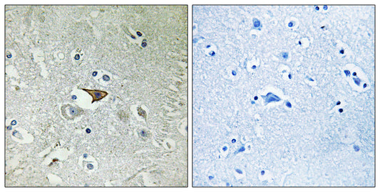CKR-5 Rabbit Polyclonal Antibody