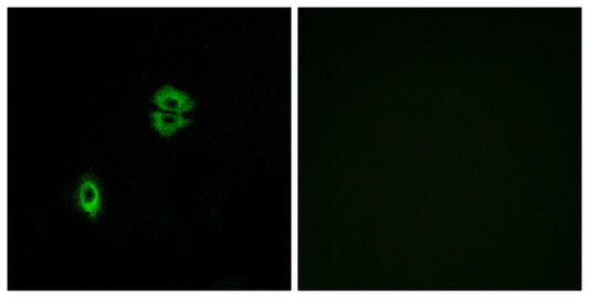 CKR-7 Rabbit Polyclonal Antibody