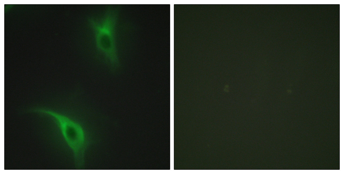 Cks1 Rabbit Polyclonal Antibody