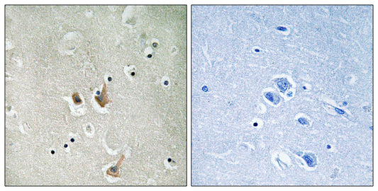 Cks2 Rabbit Polyclonal Antibody