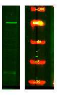 CLASR Rabbit Polyclonal Antibody