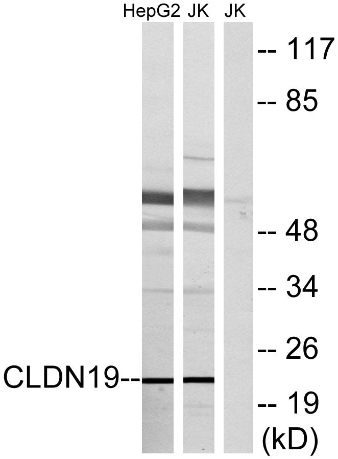 Claudin-19 Rabbit Polyclonal Antibody