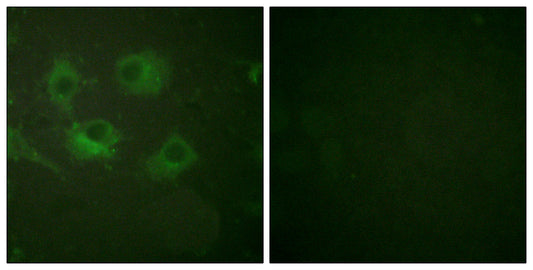 Claudin-3 Rabbit Polyclonal Antibody