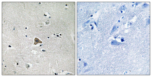 Claudin-4 Rabbit Polyclonal Antibody