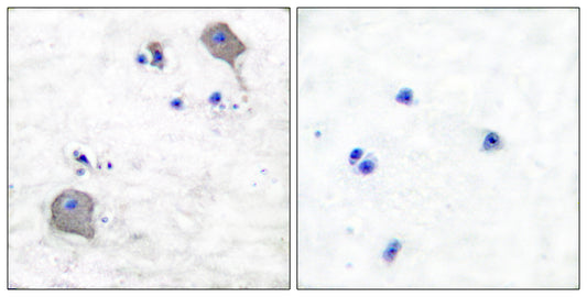 Claudin-5 Rabbit Polyclonal Antibody