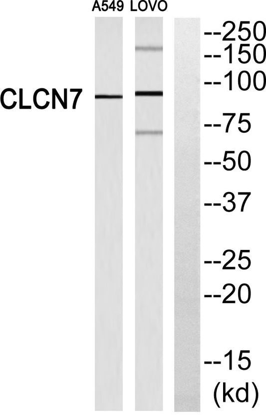 CLC-7 Rabbit Polyclonal Antibody