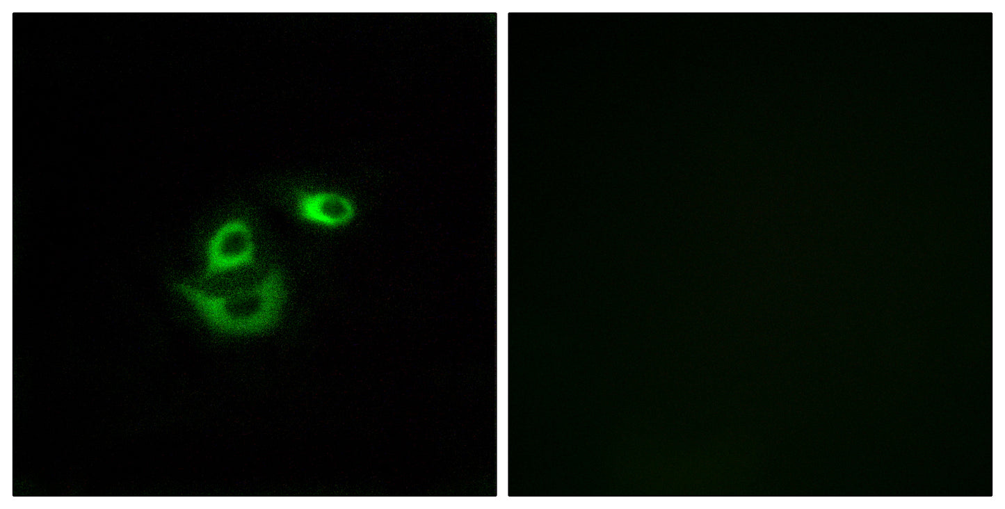 CLCC1 Rabbit Polyclonal Antibody