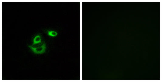 CLCC1 Rabbit Polyclonal Antibody