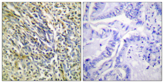 Cleaved-Aggrecan (D369) Rabbit Polyclonal Antibody
