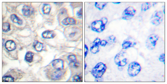 Cleaved-Bad (D71) Rabbit Polyclonal Antibody