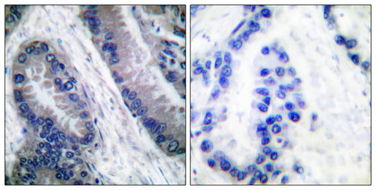 Cleaved-Caspase-1 (M211) Rabbit Polyclonal Antibody