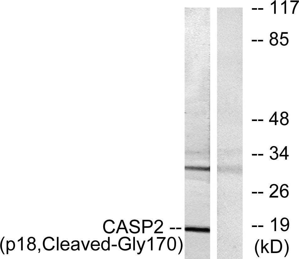 Cleaved-Caspase-2 p18 (G170) Rabbit Polyclonal Antibody
