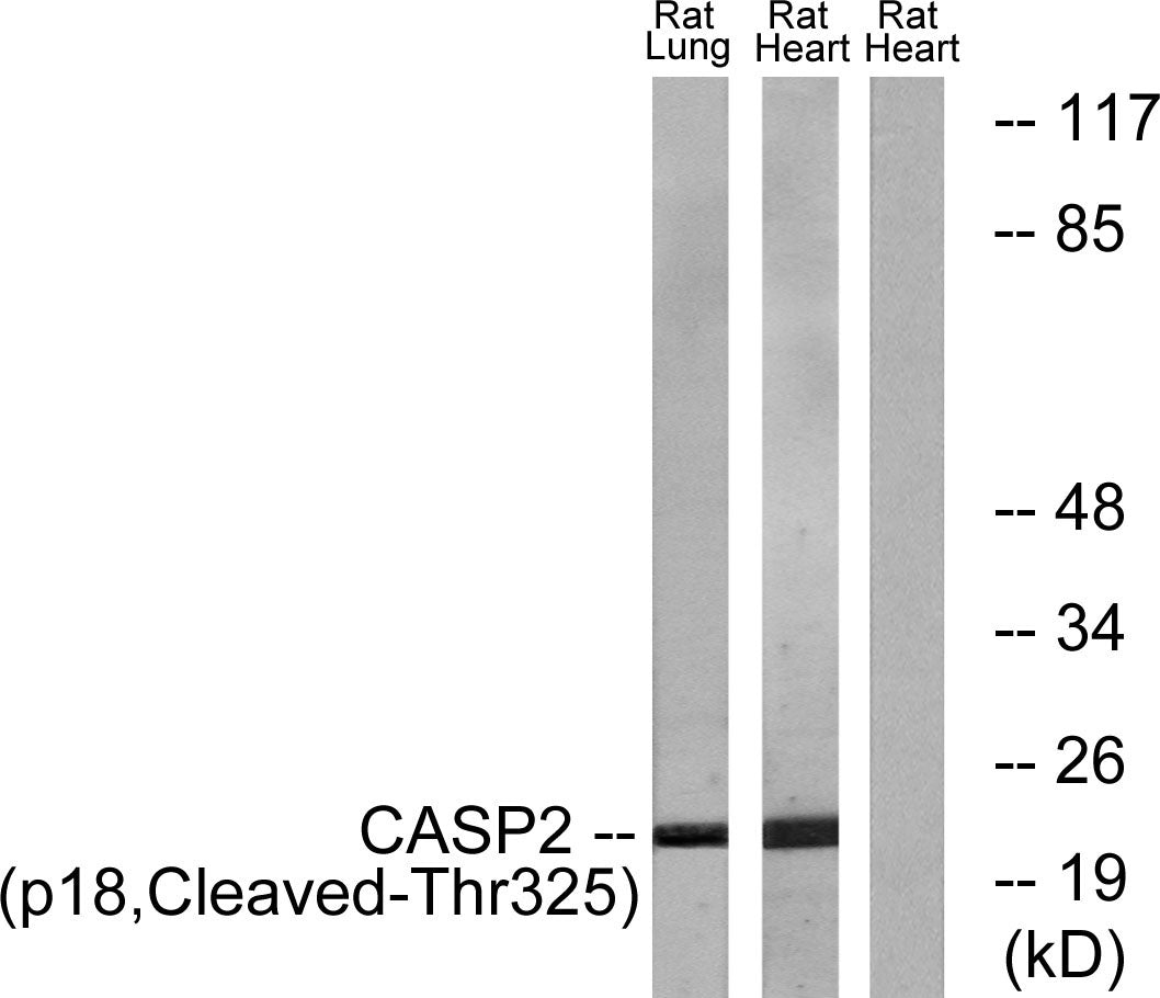 Cleaved-Caspase-2 p18 (T325) Rabbit Polyclonal Antibody