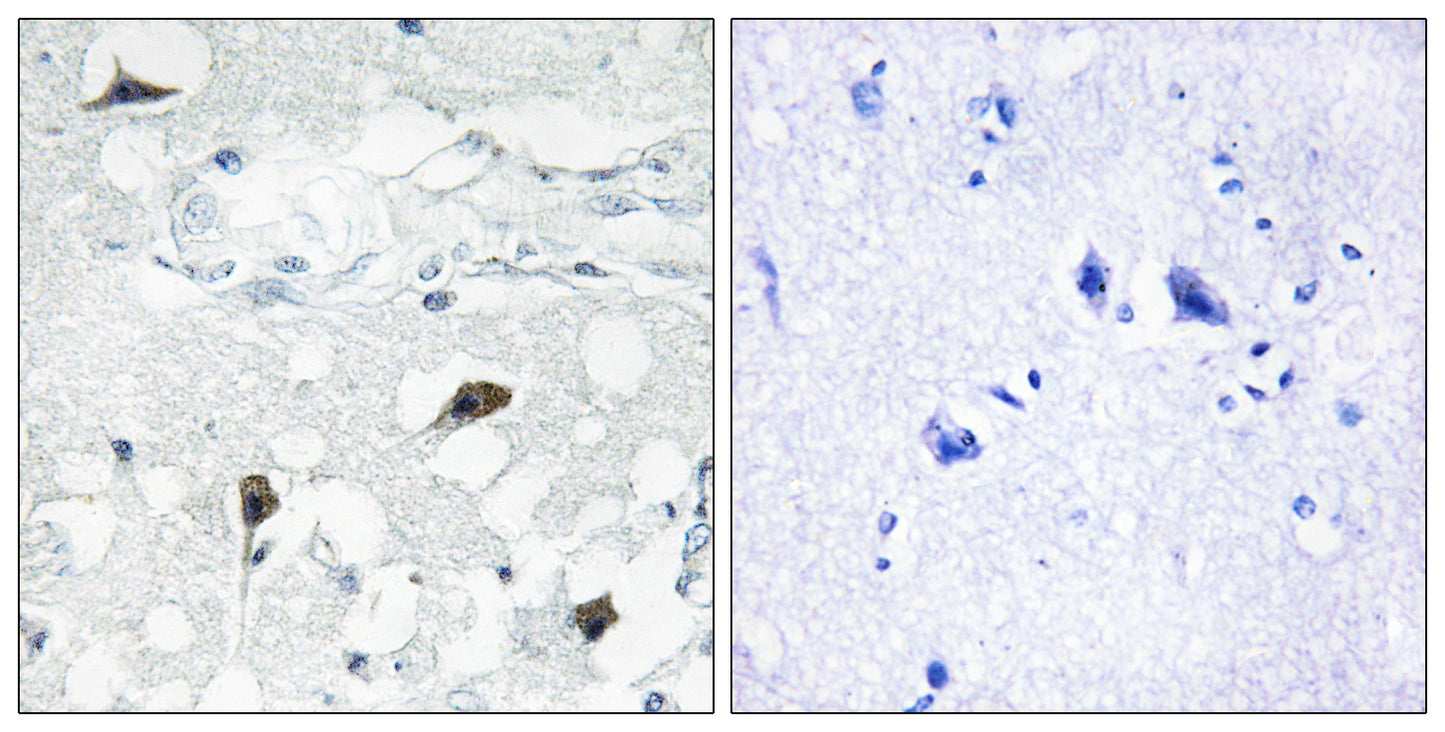 Cleaved-Caspase-3 p12 (D175) Rabbit Polyclonal Antibody