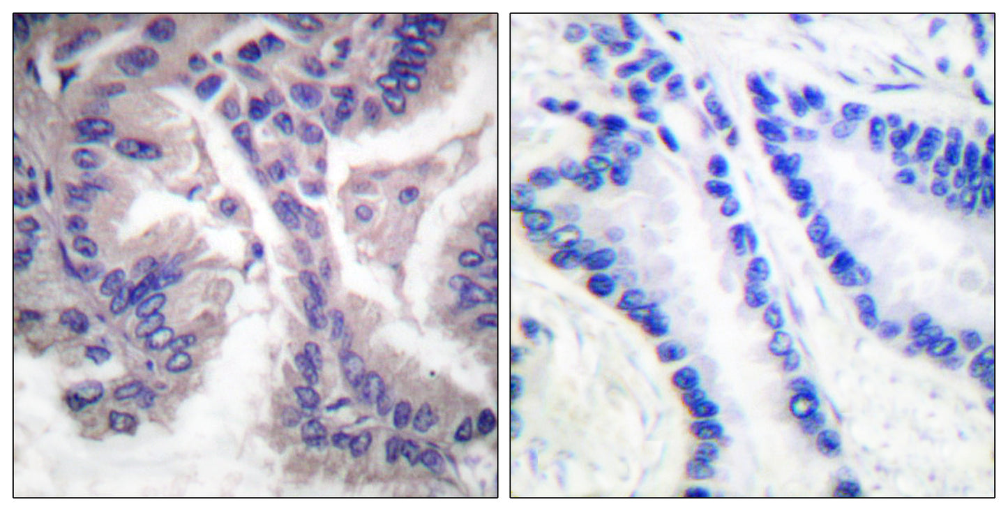 Cleaved-Caspase-6 p18 (D162) Rabbit Polyclonal Antibody