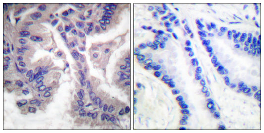 Cleaved-Caspase-6 p18 (D162) Rabbit Polyclonal Antibody