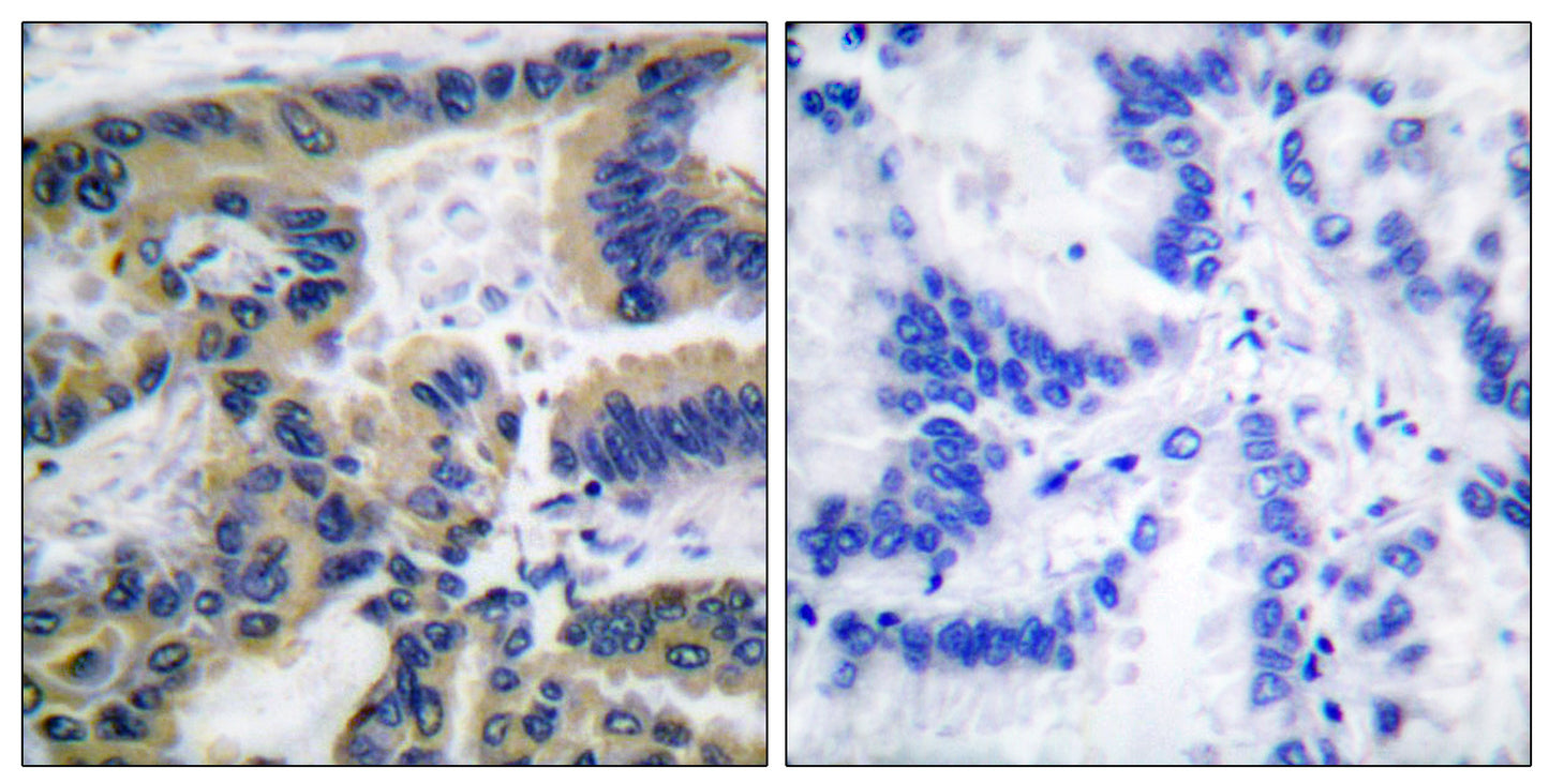 Cleaved-Caspase-7 (S199) Rabbit Polyclonal Antibody