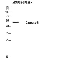 Cleaved-Caspase-8 p18 (S217) Rabbit Polyclonal Antibody
