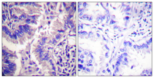 Cleaved-Caspase-9 p35 (D315) Rabbit Polyclonal Antibody