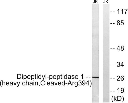 Cleaved-Cathepsin C HC (R394) Rabbit Polyclonal Antibody