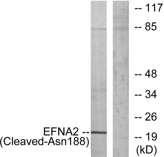 Cleaved-Ephrin-A2 (N188) Rabbit Polyclonal Antibody