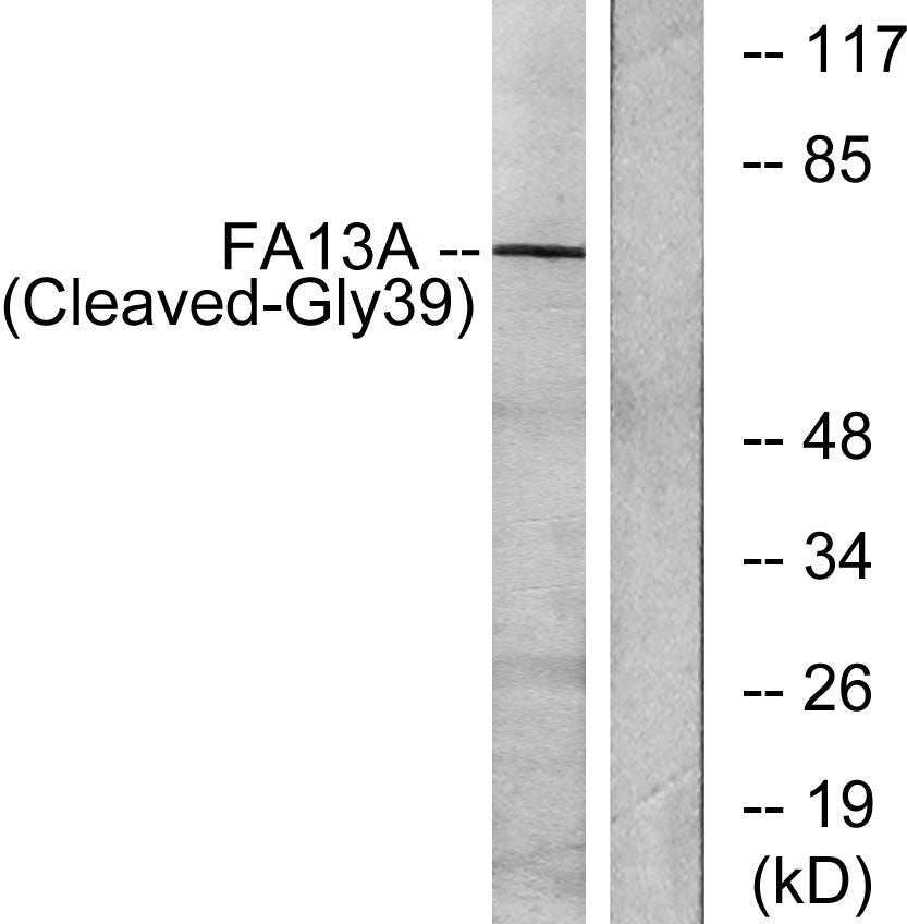 Cleaved-Factor XIIIa (G39) Rabbit Polyclonal Antibody