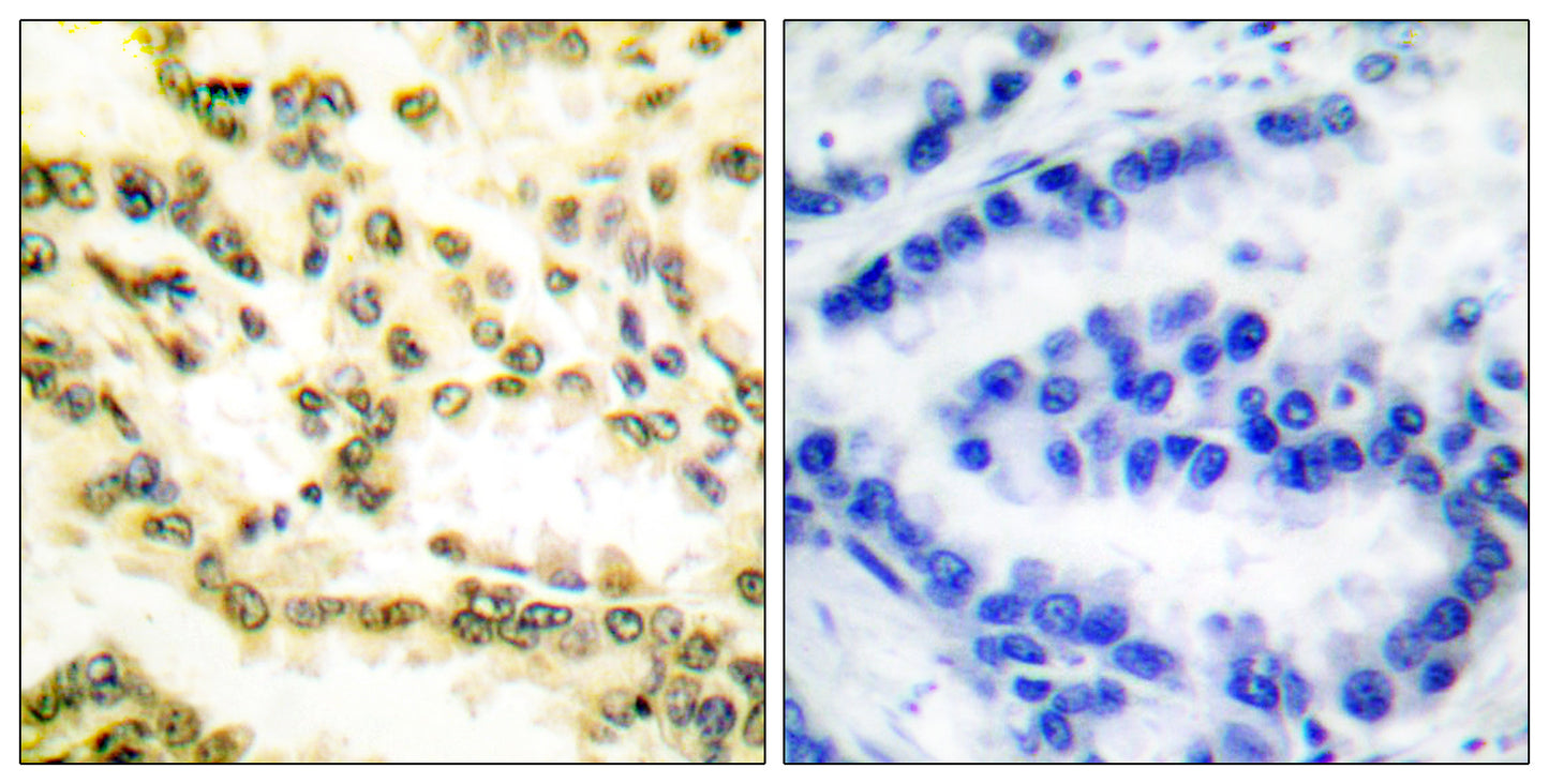 Cleaved-Lamin A (D230) Rabbit Polyclonal Antibody
