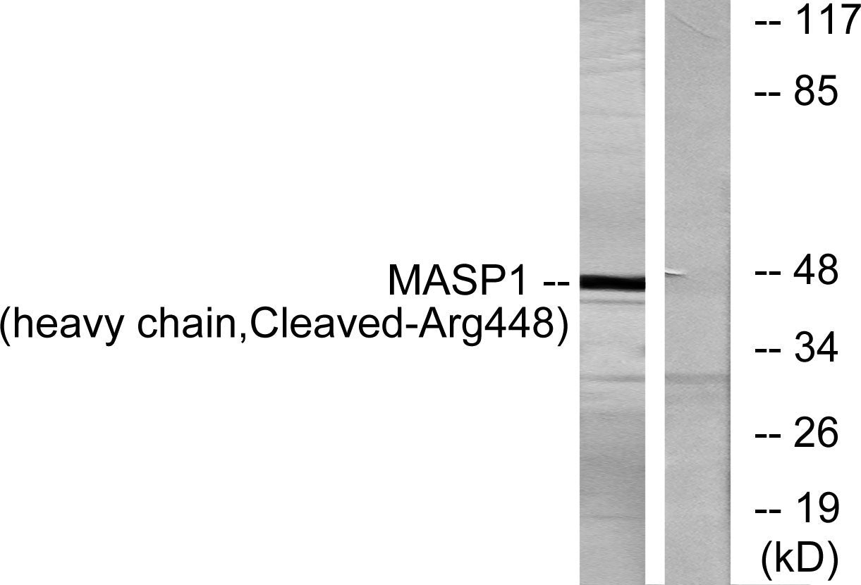 Cleaved-MASP-1 HC (R448) Rabbit Polyclonal Antibody