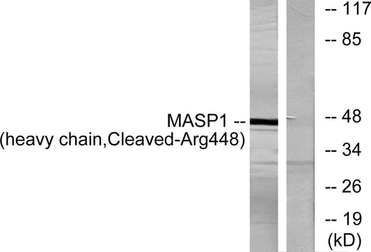 Cleaved-MASP-1 HC (R448) Rabbit Polyclonal Antibody