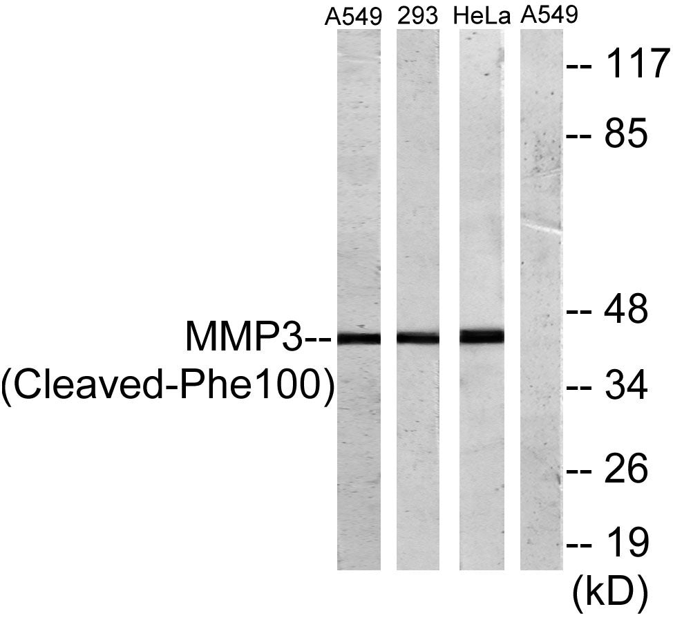 Cleaved-MMP-3 (F100) Rabbit Polyclonal Antibody