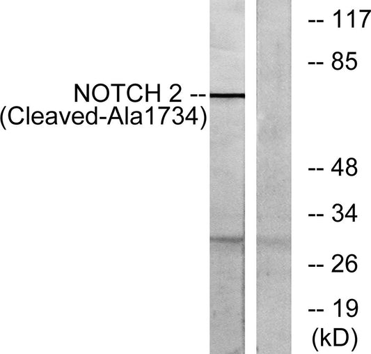 Cleaved-Notch 2 (A1734) Rabbit Polyclonal Antibody