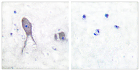 Cleaved-Notch 2 (D1733) Rabbit Polyclonal Antibody