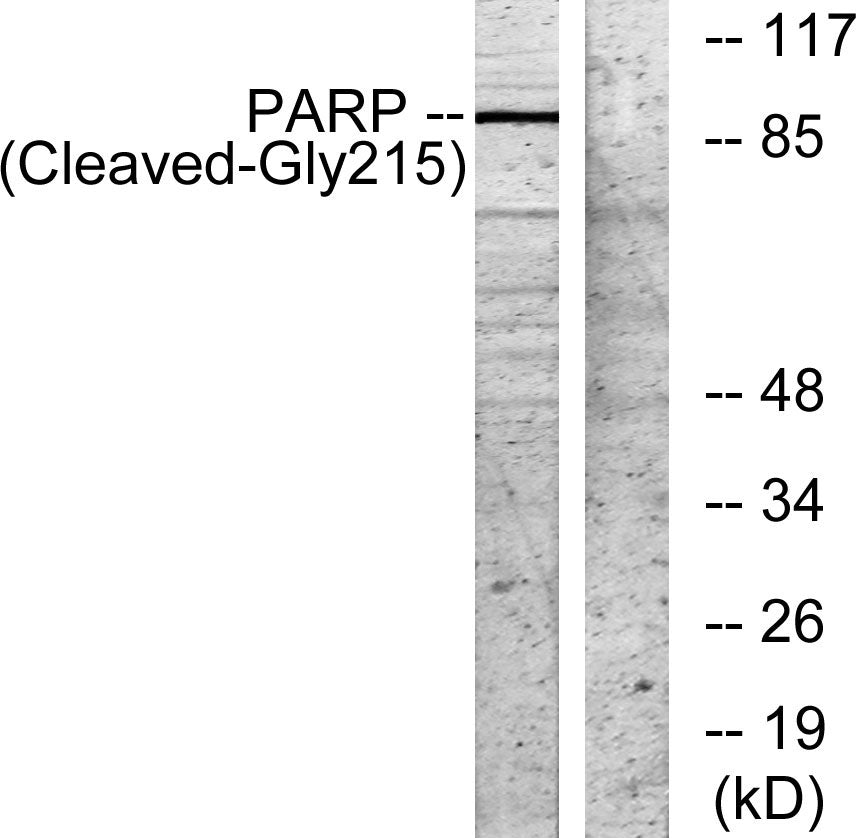 Cleaved-PARP-1 (G215) Rabbit Polyclonal Antibody
