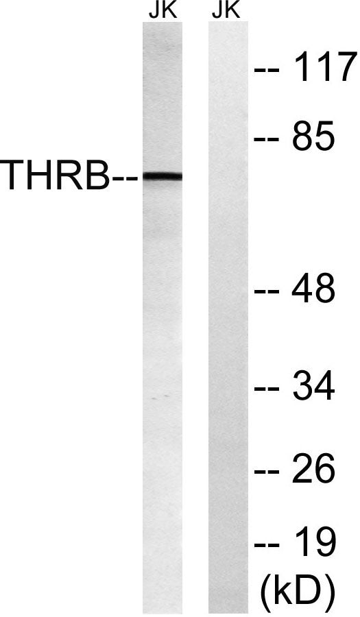 Cleaved-Thrombin APII (R327) Rabbit Polyclonal Antibody