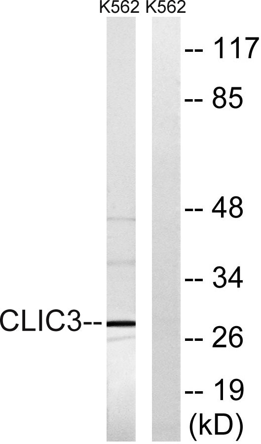 CLIC3 Rabbit Polyclonal Antibody