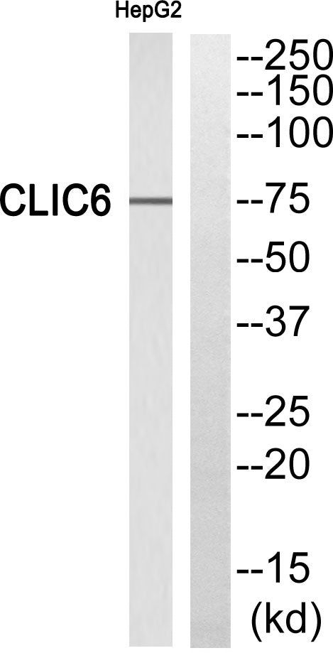 CLIC6 Rabbit Polyclonal Antibody