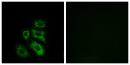 CLIP3 Rabbit Polyclonal Antibody