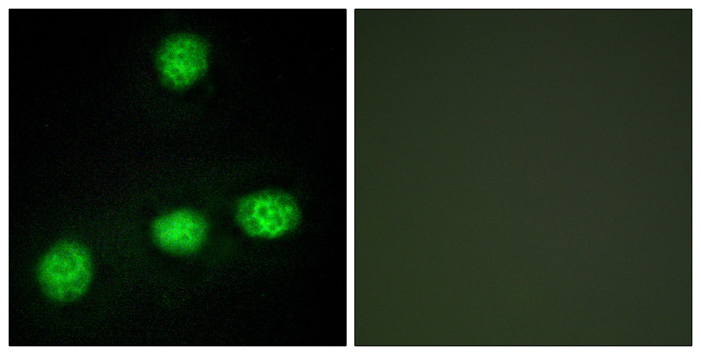 CLK1 Rabbit Polyclonal Antibody