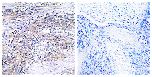 CLN6 Rabbit Polyclonal Antibody