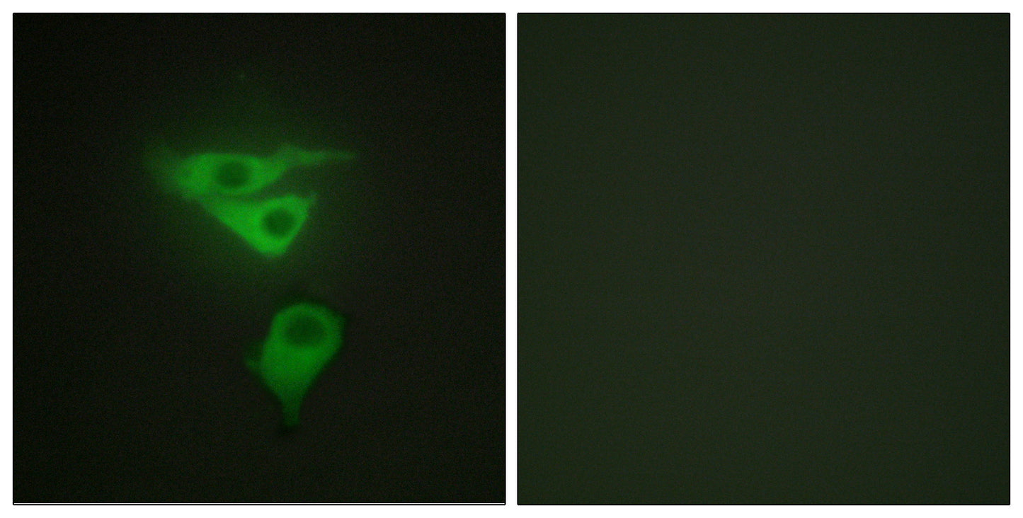CLP36 Rabbit Polyclonal Antibody