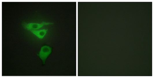 CLP36 Rabbit Polyclonal Antibody