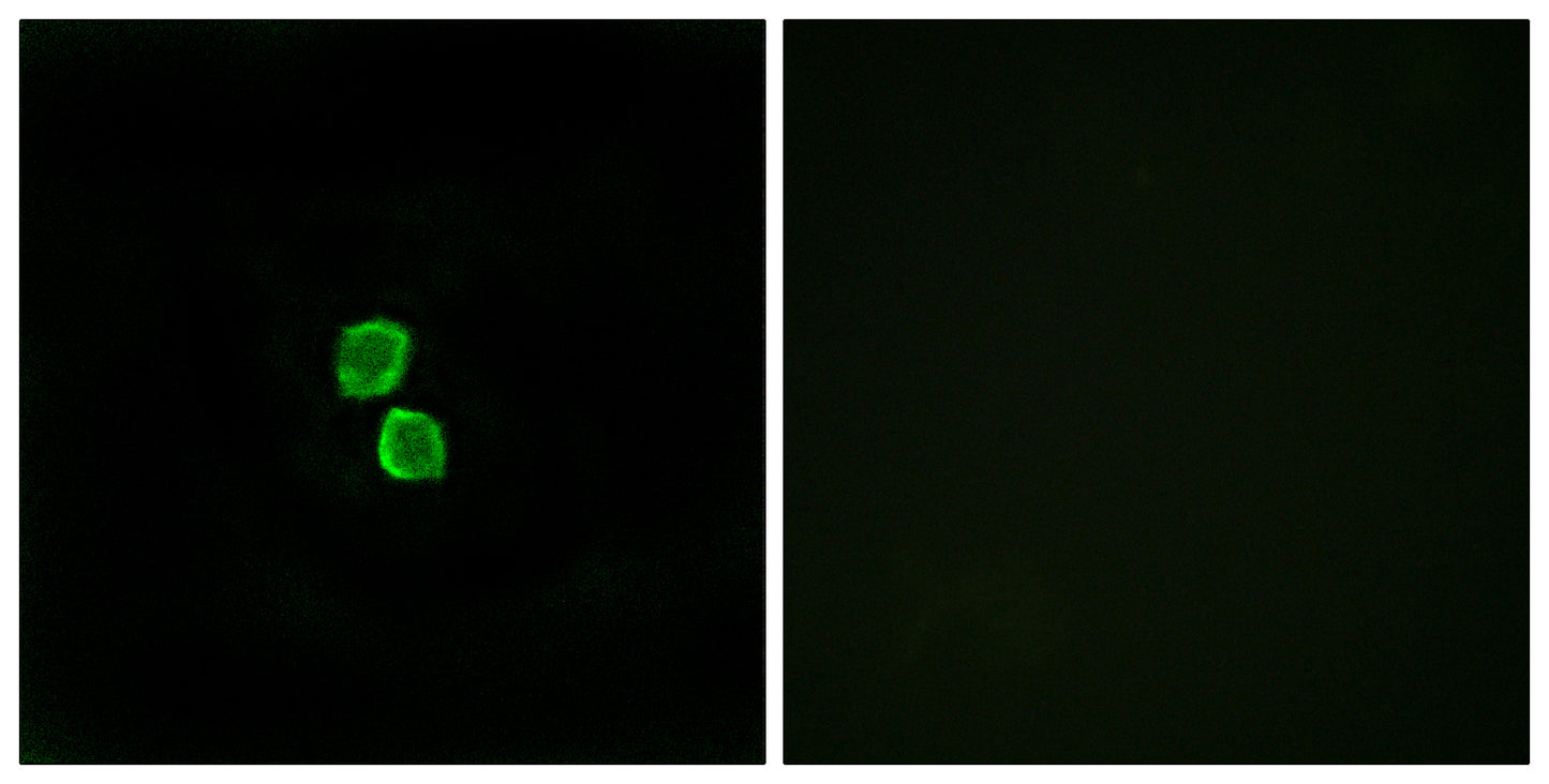 CMTM1 Rabbit Polyclonal Antibody