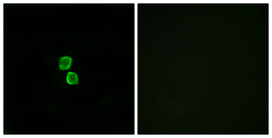 CMTM1 Rabbit Polyclonal Antibody
