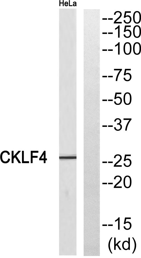CMTM4 Rabbit Polyclonal Antibody